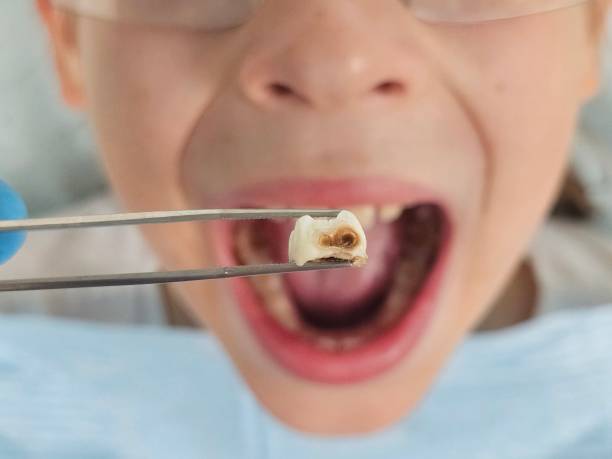 Best Walk-In Emergency Dentist in Standish, MI